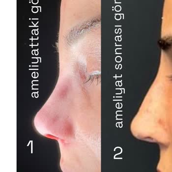 Prof. Dr. Esin Yalçınkaya Hem Sağlık Hem De Estetik Açıdan Tam Bir Hayal Kırıklığına Dönüştü