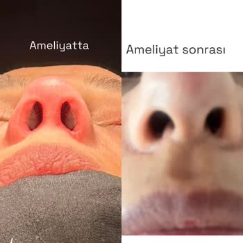 Prof. Dr. Esin Yalçınkaya Hem Sağlık Hem De Estetik Açıdan Tam Bir Hayal Kırıklığına Dönüştü