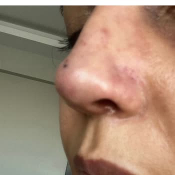 Prof. Dr. Esin Yalçınkaya Hem Sağlık Hem De Estetik Açıdan Tam Bir Hayal Kırıklığına Dönüştü