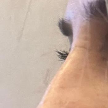 Prof. Dr. Esin Yalçınkaya Hem Sağlık Hem De Estetik Açıdan Tam Bir Hayal Kırıklığına Dönüştü