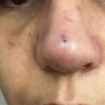 Prof. Dr. Esin Yalçınkaya Hem Sağlık Hem De Estetik Açıdan Tam Bir Hayal Kırıklığına Dönüştü