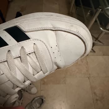 Kısa Sürede Deforme Olan Adidas Ayakkabıda Kalite Sorunu Ve Yetersiz İnceleme