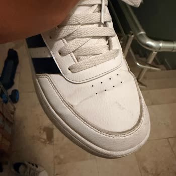 Kısa Sürede Deforme Olan Adidas Ayakkabıda Kalite Sorunu Ve Yetersiz İnceleme