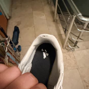 Kısa Sürede Deforme Olan Adidas Ayakkabıda Kalite Sorunu Ve Yetersiz İnceleme