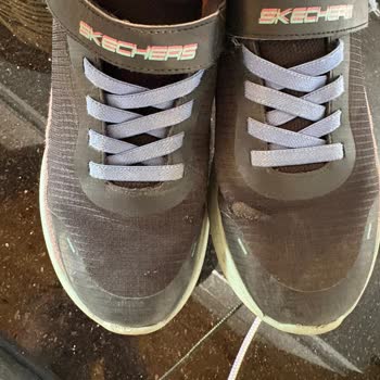 Skechers Çocuk Ayakkabısının Hızlı Deformasyonu Ve Mağaza Reddi