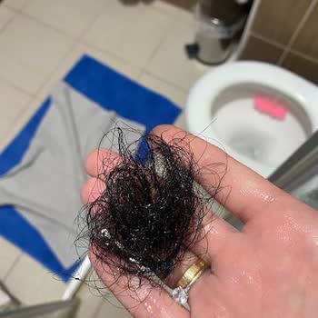 Garnier Şampuanı Sonrası Ani Saç Dökülmesi Ve Şirketin Cevapsızlığı