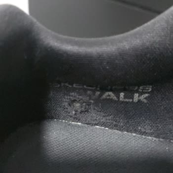Skechers Ayakkabısında İç Kısım Yırtılması Ve Haksız Müşteri Hatası Kararı