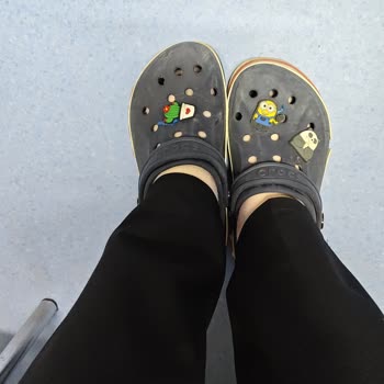 Crocs Lacivert Terliğimde Ciddi Bir Boya Sorunu Yaşıyorum