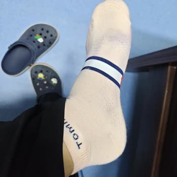 Crocs Lacivert Terliğimde Ciddi Bir Boya Sorunu Yaşıyorum