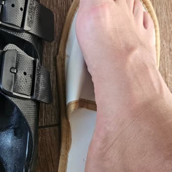 Birkenstock Ayak Tahrişi Ve Markanın Çözüm Sunmaması
