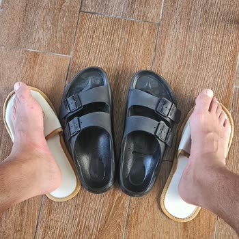 Birkenstock Ayak Tahrişi Ve Markanın Çözüm Sunmaması