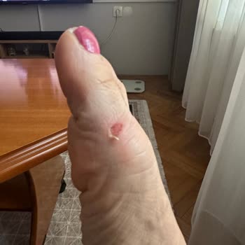 Ayakları Yakan Ve Su Toplayan Açık Ayakkabı İçin Değişim Talebi