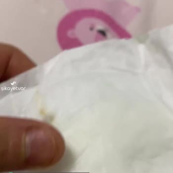 Sleepy 4 Numaralı Çocuk Bezinde Yabancı Cisim Gördüm