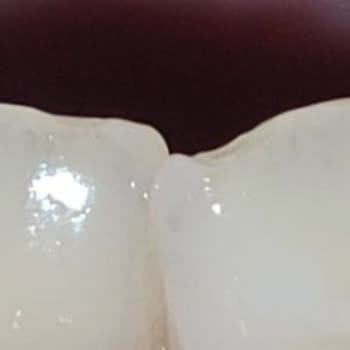 Çitlekçi Cipsinde Çakıl Taşı Çıktı, Çocuğumun Dişi Kırıldı