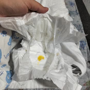 Molfix 1 Numaralı Bebek Bezlerinde Sırt Ve Bel Sızdırması
