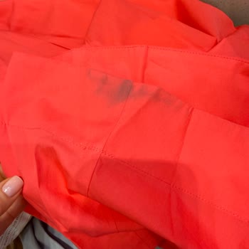 Zara’dan Gelen Kirli, Ütü Yanıklı Ve Deforme Elbise, Yetersiz Müşteri Hizmeti