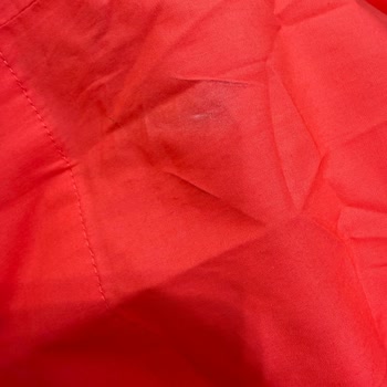 Zara’dan Gelen Kirli, Ütü Yanıklı Ve Deforme Elbise, Yetersiz Müşteri Hizmeti