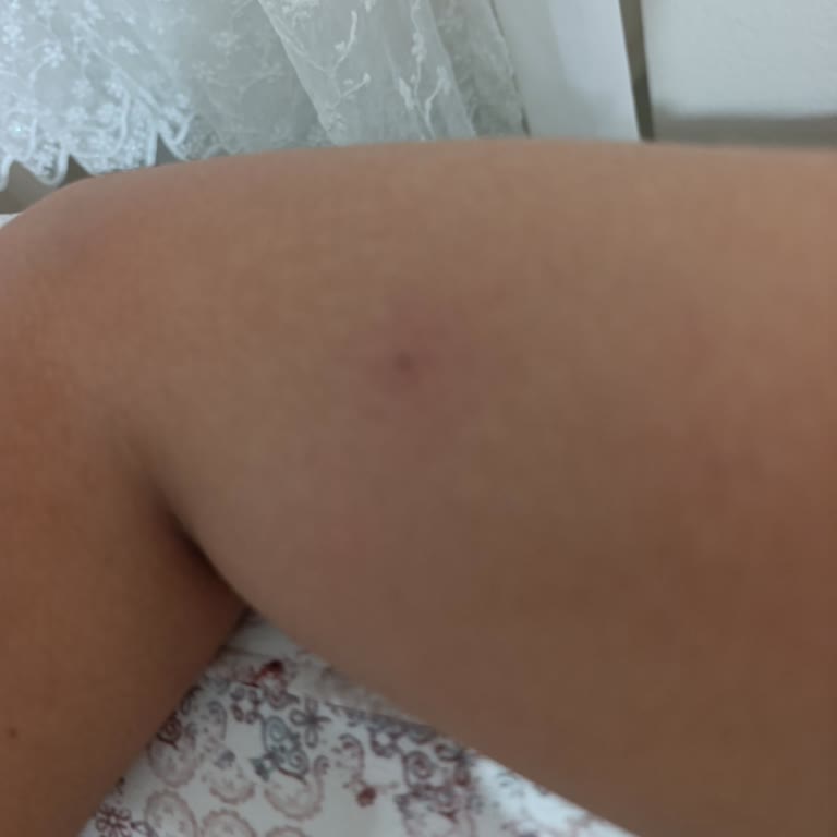 Acil Serviste Şikayetimin Ciddiye Alınmaması Ve Yetersiz Muayene