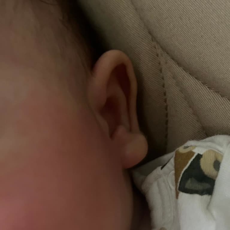 Bebek Cildinde Şiddetli Kızarıklık Ve Tahriş Yaratan Uni Baby Islak Mendil