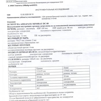 Wingie Вынужденный Возврат Авиабилетов По Причине Болезни Пассажира