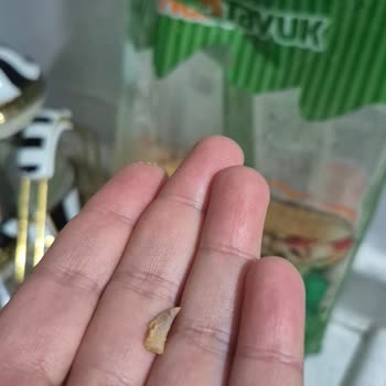 Has Tavuk Dondurulmuş Dönerinde Çocuğa Tehlikeli Kemiğin Çıkması
