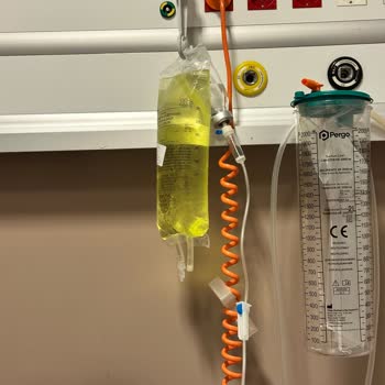 Serum Değişimi İhmal Edildi, Hasta Takibi Yetersiz Ve Personel Umursamaz