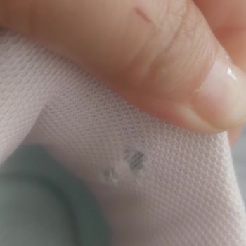 Çocuğumun Ayağını Zarar Veren Ayakkabının Ücret İadesi Talebi