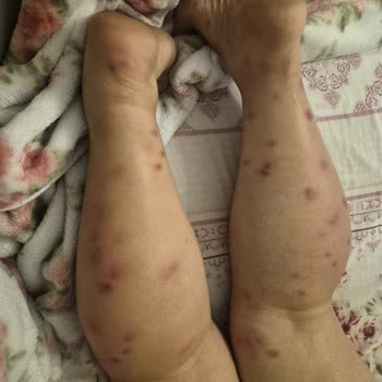 Tur Sorumlusunun Yardım Etmemesi Ve Otelde Hijyen Sorunları