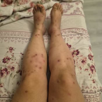 Tur Sorumlusunun Yardım Etmemesi Ve Otelde Hijyen Sorunları