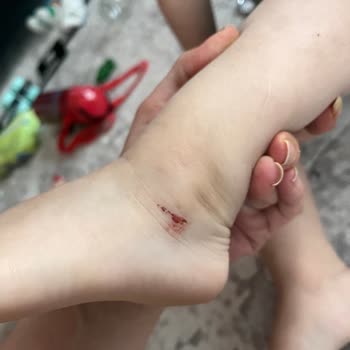 Bebek Ayak Kesildi: LCW Sandalet Güvenlik Sorunu Ve Yetersiz Müşteri Hizmeti