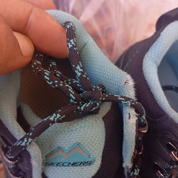 Skechers Botta Kısa Sürede Deformasyon, Garanti Reddine Karşı İade Talebi