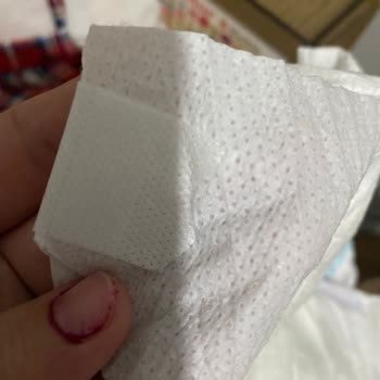 Molfix 5 Numaralı 100’lü Pakette Cırtı Yapışık Ve Açılmıyor