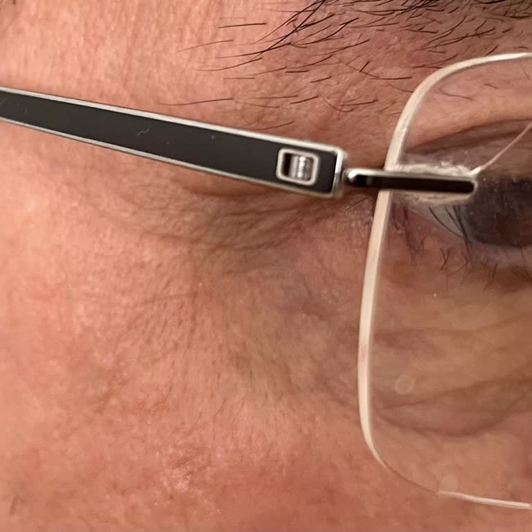 Atasun Optik'te Tekrarlanan Ayarlamalar Sonrası Sağ Lens Çatladı Ve İşçilik Hatası