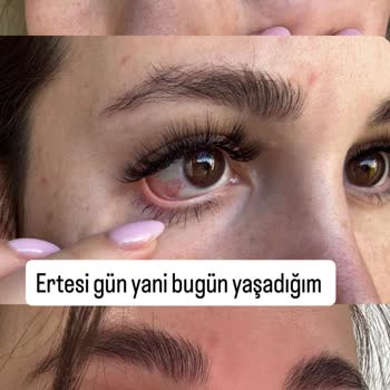 My Boni Studio Kirpik İşleminde Sağlık Riski, Yanıltıcı Hizmet Ve Hakaretli Davranış