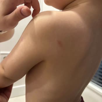 Oyun Bahçesi Anaokulu Çizik İzleri Ve Hakaretli Tutumuna Karşı Özür Talebi