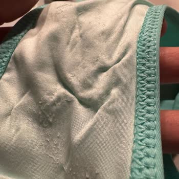 Koruma Bandı Nedeniyle Defolu Bikini İçin Değişim Reddedildi