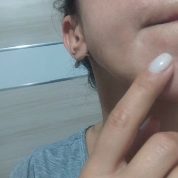 Yves Rocher Tonik Kullanımından Sonra Yüzümde Yağ Bezeleri Ve İade Talebi