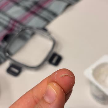 Activia Yoğurtta Yabancı Madde Ve Güven Kırılması