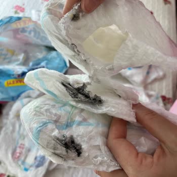 Molfix Bebek Bezinde Kanserojen Boya Şüphesi Ve Ürün Geri Çağırma Talebi