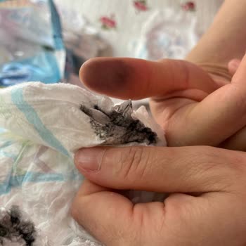 Molfix Bebek Bezinde Kanserojen Boya Şüphesi Ve Ürün Geri Çağırma Talebi