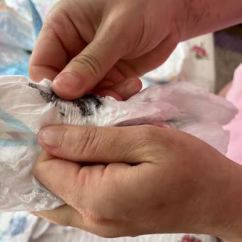 Molfix Bebek Bezinde Kanserojen Boya Şüphesi Ve Ürün Geri Çağırma Talebi