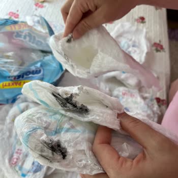 Molfix Bebek Bezinde Kanserojen Boya Şüphesi Ve Ürün Geri Çağırma Talebi