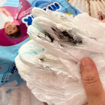 Molfix Bebek Bezinde Kanserojen Boya Şüphesi Ve Ürün Geri Çağırma Talebi
