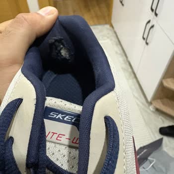 Skechers Ayakkabısında Kısa Sürede Oluşan Deformasyon Ve Mağazanın Kullanıcı Hatası İddiası