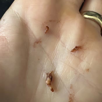 Dr. Oetker Pastacı Kremasında Solucan Benzeri Parçalar Bulundu