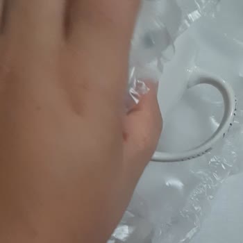 Kırık Kupa İçin PTT Sorumluluğu Ve Çözüm Talebi
