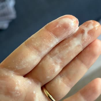 Magnum Mini Badem Dondurmalarındaki Pütürlü Yapı Sağlık Endişesi Ve Maddi Kayıp