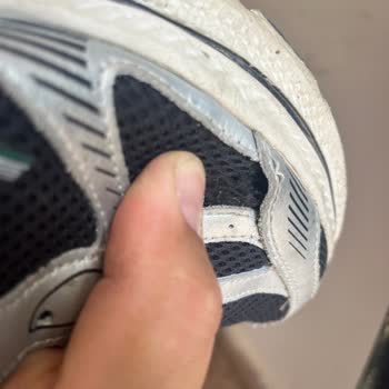 Kısa Sürede Açılan Yan File Ve Deforme Olmuş Topuk İçin Ücret İadesi Talebi