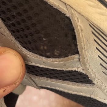 Kısa Sürede Açılan Yan File Ve Deforme Olmuş Topuk İçin Ücret İadesi Talebi