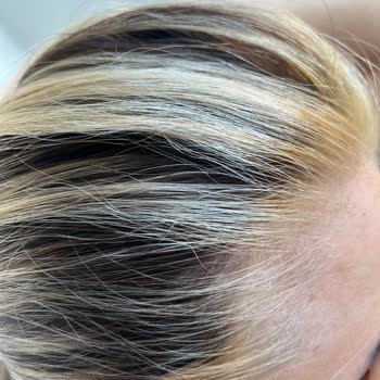 6.500 TL Ödemesi İçin Ombre Yanığı Ve İade Talebi